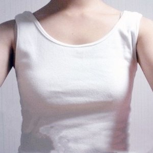 廣元美華楊林醫(yī)生做的自體脂肪隆胸，兩個月的果圖片分享~