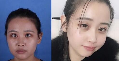 好消息!南寧華美10月20-21日邀請(qǐng)廖連平、劉志剛和徐艦來(lái)院坐診~