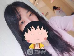 成都嬌點(diǎn)姜宇祿雙眼皮修復(fù)案例，重獲新生！