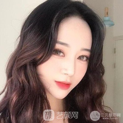 上海華美楊亞益主任做的芭比雙眼皮，果很好哦~