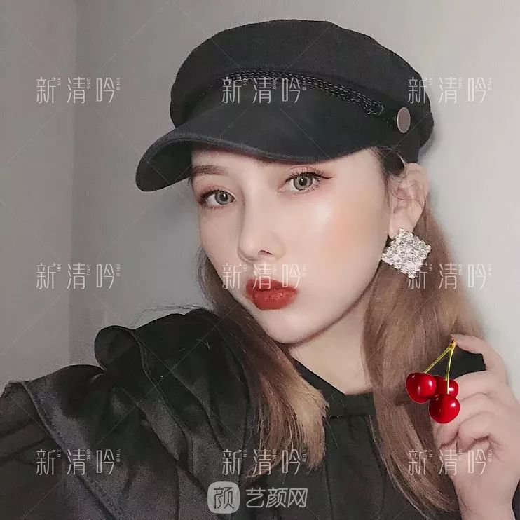 耳軟骨隆鼻果怎么樣？案例照片一覽~