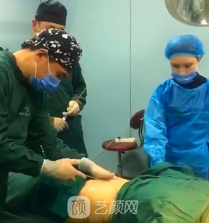 葫蘆島頤正夏秉成鼻部手術+SVF自體脂肪多方面部填充案例~