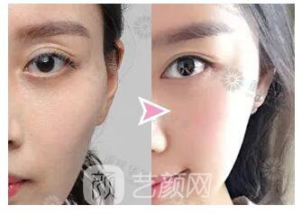 動(dòng)一動(dòng)這些部位，臉顯嫩10倍