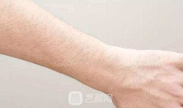深圳翠綠寶石激光脫毛如何？我們一起來了解一下