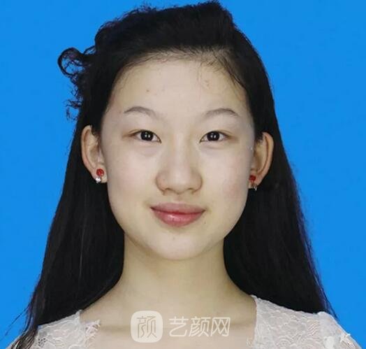 鄭裕錫歐巴駕到：扇形&平行如何選？