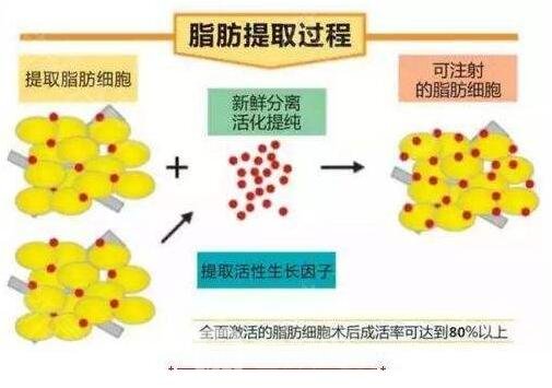 提取脂肪的過程