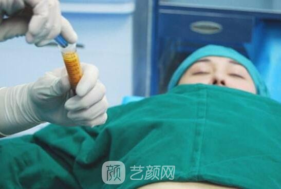 廉紅偉在水動力吸脂方面有著嫻熟的手法，他的方法對身體傷害極小