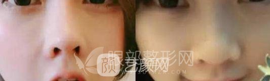 斗魚第一女主播馮提莫的進(jìn)化史：從素人到網(wǎng)紅！