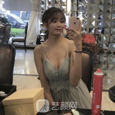 長沙劉超峰醫(yī)生做鼻修復(fù)怎么樣？2022招牌案例公布